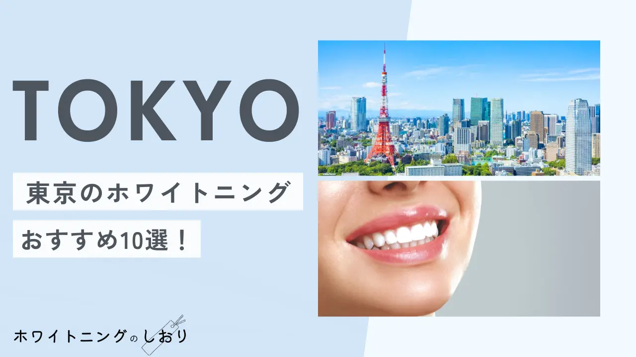東京のおすすめホワイトニング10選！オフィスや安い所を紹介