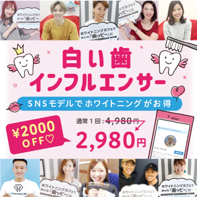 SNSモデル募集-ホワイトニングカフェ